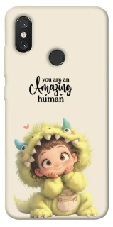 Чохол на Xiaomi Mi 8 You are amazing фото 1 з 1