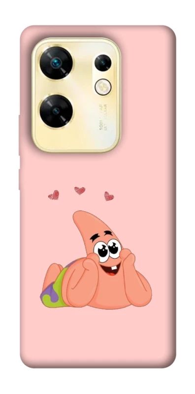 Чохол на Infinix Zero 30 4G Патрік Стар фото 1 з 1