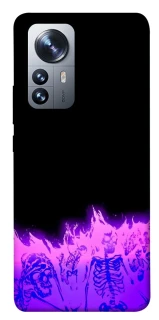 Чехол на Xiaomi 12 / 12X Funny moments фото 1 из 1