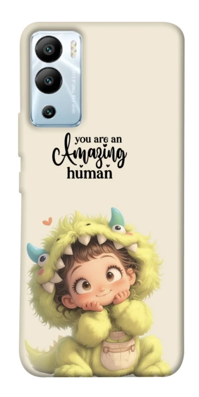 Чехол на Infinix Hot 12i You are amazing фото 1 из 1