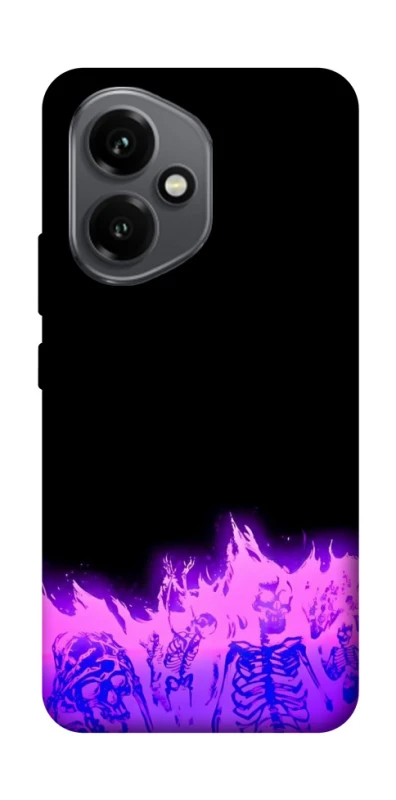 Чохол на Honor 400 Funny moments фото 1 з 1