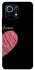 Чохол на Xiaomi Mi 11 Pair romantic theme ver.10 фото 1 з 1