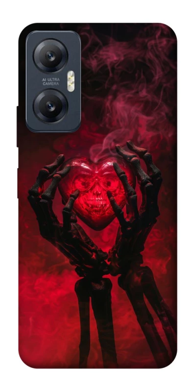 Чехол на Infinix Hot 20 5G Heart in the hands of a skeleton фото 1 Чехол на Infinix Hot 20 5G Heart in the hands of a skeleton фото 1 из 1