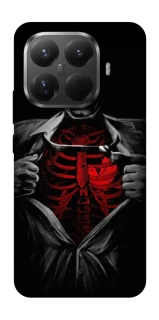 Чехол на Xiaomi 15T Pro Skeleton Heart фото 1 из 1