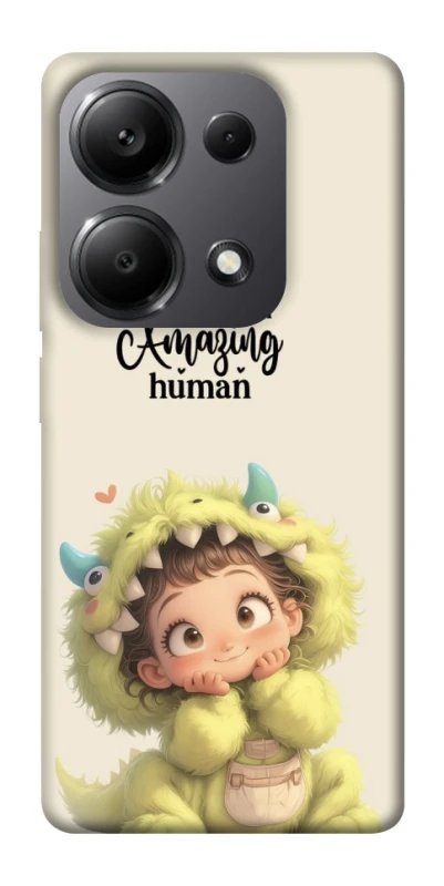 Чохол на Xiaomi Redmi Note 13 Pro 5G You are amazing фото 1 з 1