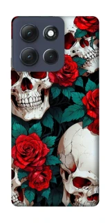 Чехол на Motorola Moto G86 Power skull and rose фото 1 из 1