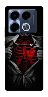 Чохол на Infinix Note 40 4G Skeleton Heart фото 1 з 1