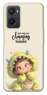 Чохол на Oppo A96 You are amazing фото 1 з 1