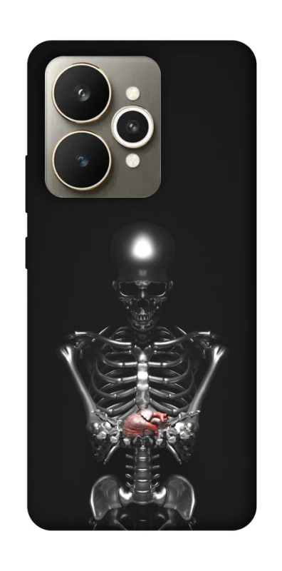 Чохол на Realme 15 Скелетон фото 1 з 1