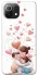 Чохол на Xiaomi Mi 11 Lite Mother's Day ver.1 фото 1 з 1