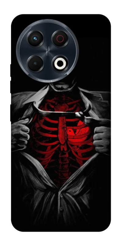 Чохол на TECNO Spark 30 Pro (KL7) Skeleton Heart фото 1 з 1