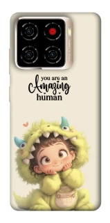 Чохол на ZTE Blade A56 You are amazing фото 1 з 1