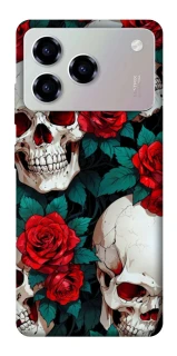Чохол на ZTE Blade A76 skull and rose фото 1 з 1