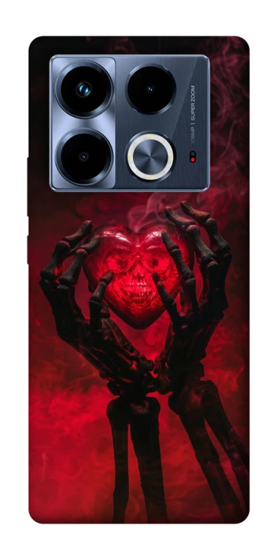 Чохол на Infinix Note 40 4G Heart in the hands of a skeleton фото 1 з 1