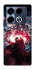 Чохол на Infinix Note 40 4G Doctor Strange фото 1 з 1