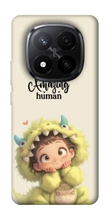 Чохол на Xiaomi Redmi Note 14 Pro+ 5G You are amazing фото 1 з 1