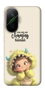 Чохол на Xiaomi Poco F7 You are amazing фото 1 з 1