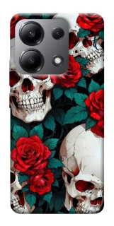Чехол на Xiaomi Redmi Note 13 4G skull and rose фото 1 из 1