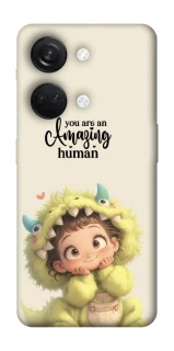 Чохол на OnePlus Nord 3 You are amazing фото 1 з 1