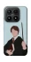 Чехол на Xiaomi 17 Harry Potter v5 фото 1 из 1