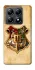 Чохол на Xiaomi 14T Pro Harry Potter mood v1 фото 1 з 1